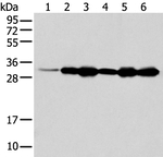 NUDT22 Antibody in Western Blot (WB)