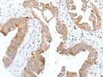 RhoV Polyclonal Antibody