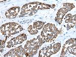 RhoV Antibody in Immunohistochemistry (Paraffin) (IHC (P))
