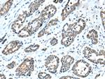 NPL Polyclonal Antibody