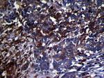 GMFB Polyclonal Antibody