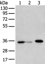 DHRSX Antibody in Western Blot (WB)