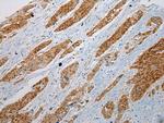 GSTM4 Polyclonal Antibody