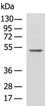Znf672 Antibody in Western Blot (WB)