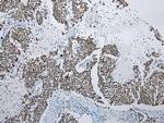 ZNF22 Antibody in Immunohistochemistry (Paraffin) (IHC (P))