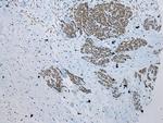 ZNF22 Antibody in Immunohistochemistry (Paraffin) (IHC (P))