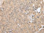 ZNF313 Antibody in Immunohistochemistry (Paraffin) (IHC (P))