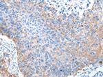 PTGIR Polyclonal Antibody