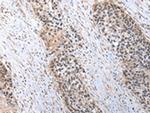 C1QB Polyclonal Antibody