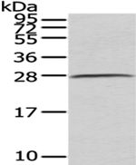 C1QB Antibody in Western Blot (WB)