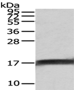 NPC2 Antibody in Western Blot (WB)