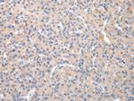 TCN2 Polyclonal Antibody
