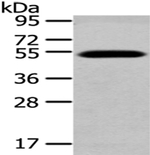 TCN2 Antibody in Western Blot (WB)