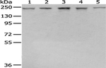 TAF172 Antibody in Western Blot (WB)