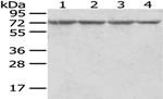RARS Antibody in Western Blot (WB)