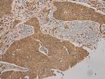 CYP20A1 Polyclonal Antibody