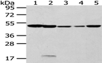 CYP20A1 Antibody in Western Blot (WB)