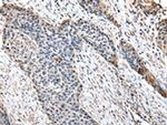 HPD Polyclonal Antibody