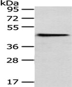 HPD Antibody in Western Blot (WB)
