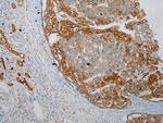 HGD Antibody in Immunohistochemistry (Paraffin) (IHC (P))