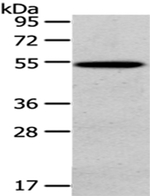 HGD Antibody in Western Blot (WB)