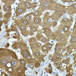 NNMT Antibody in Immunohistochemistry (Paraffin) (IHC (P))