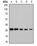 NNMT Antibody in Western Blot (WB)