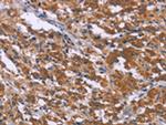 SKI Polyclonal Antibody