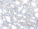 PPBP Polyclonal Antibody