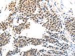 MAGEA6 Polyclonal Antibody