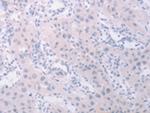 PK2L1 Polyclonal Antibody
