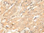 ADAM19 Polyclonal Antibody
