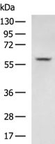 SLC8B1 Antibody in Western Blot (WB)