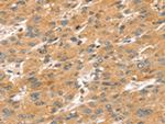 SPATA18 Polyclonal Antibody