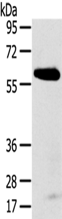 SPATA18 Antibody in Western Blot (WB)