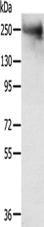 TACC2 Antibody in Western Blot (WB)