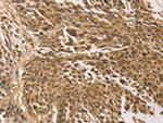 TGM7 Antibody in Immunohistochemistry (Paraffin) (IHC (P))