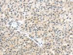 TTBK2 Antibody in Immunohistochemistry (Paraffin) (IHC (P))