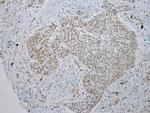 TUSC5 Polyclonal Antibody