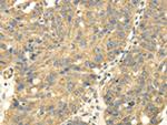 UHRF1BP1 Polyclonal Antibody