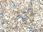 WNT2 Polyclonal Antibody