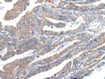 ZFAND2A Polyclonal Antibody