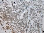 ZNF200 Antibody in Immunohistochemistry (Paraffin) (IHC (P))