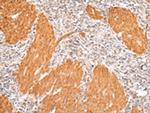 IKZF4 Polyclonal Antibody