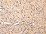 COL8A2 Antibody in Immunohistochemistry (Paraffin) (IHC (P))