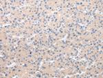 CHRM5 Polyclonal Antibody
