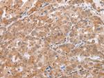 beta-Defensin 1 Polyclonal Antibody