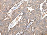 SPINK7 Polyclonal Antibody