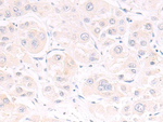 SLC2A6 Antibody in Immunohistochemistry (Paraffin) (IHC (P))