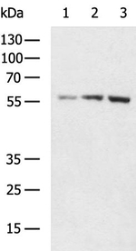 SLC2A6 Antibody in Western Blot (WB)
